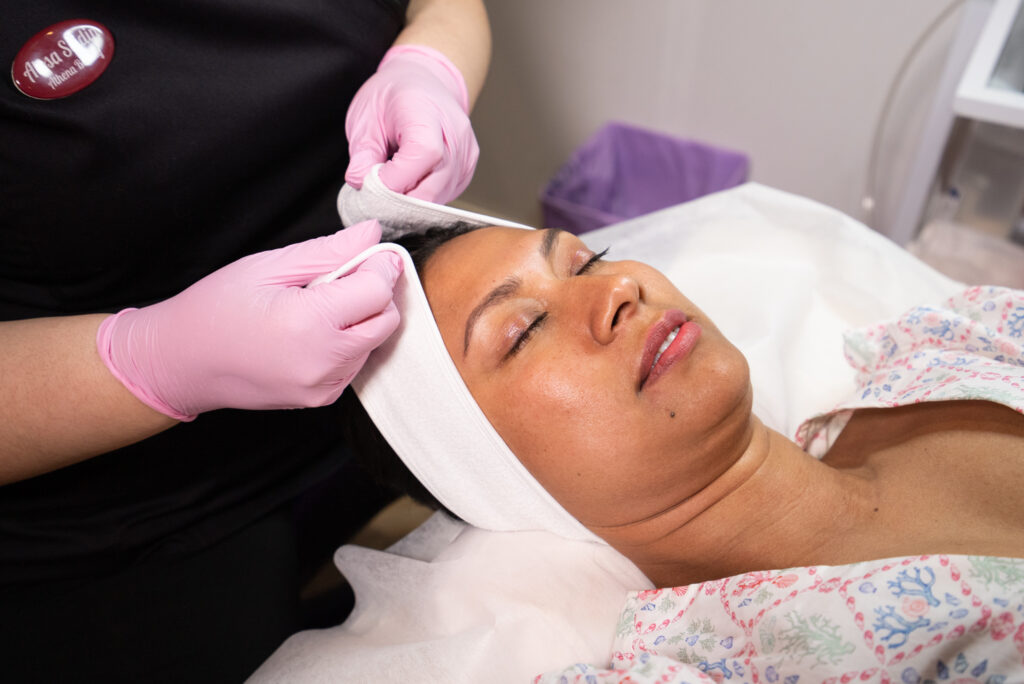 Klient under ALGNEEDLING® Biomicroneedling session, en innovativ hudförbättringsmetod.